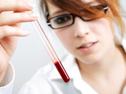 Podwyższony poziom cholesterolu