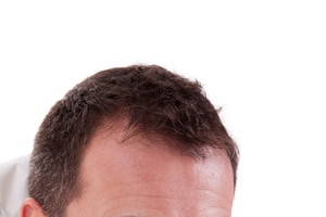 Męska menopauza