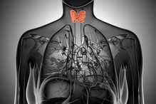 Fotolia
