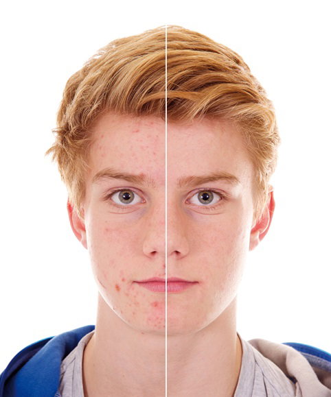 Fotolia