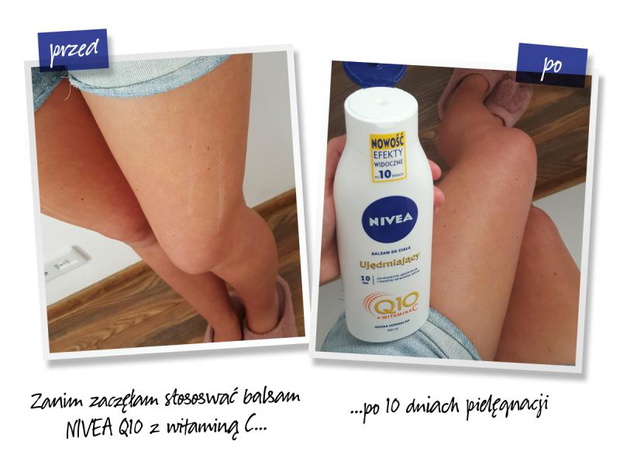 efekty-dzialania-balsamu-nivea-q10-2430024-677e3b3