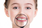 Fotolia