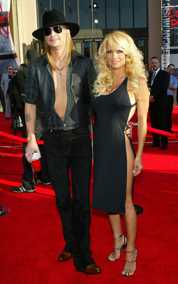 ALLONS67389PAMELA-ANDERSON-KID-ROCK-af65730