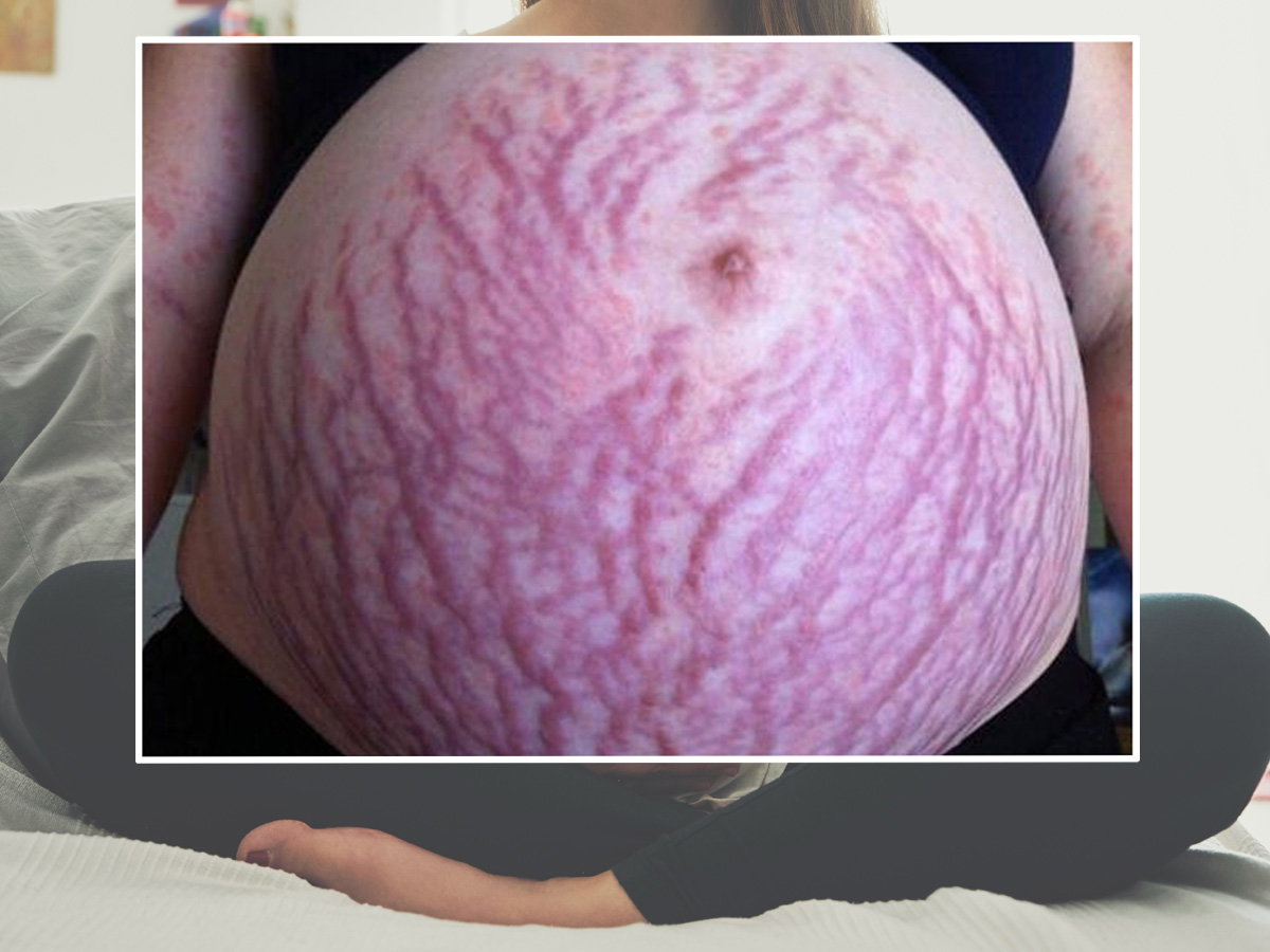 -89f28d6