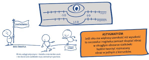 Ortosoczewki i metoda ortokorekcji wzroku infografika