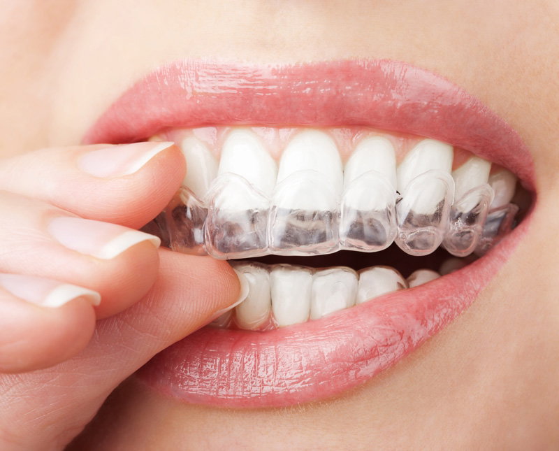 Fotolia_40515653