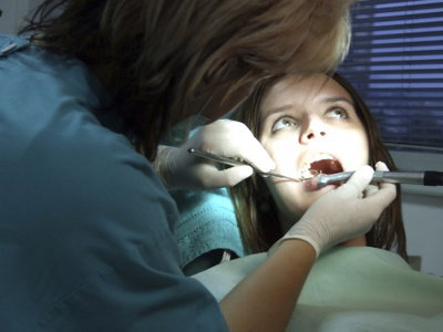 Paradontoza