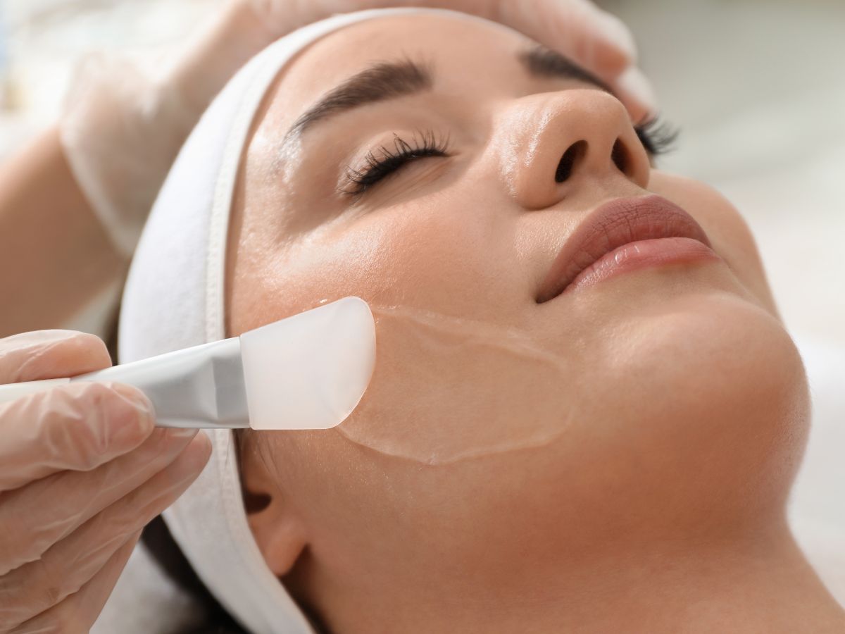 peeling chemiczny