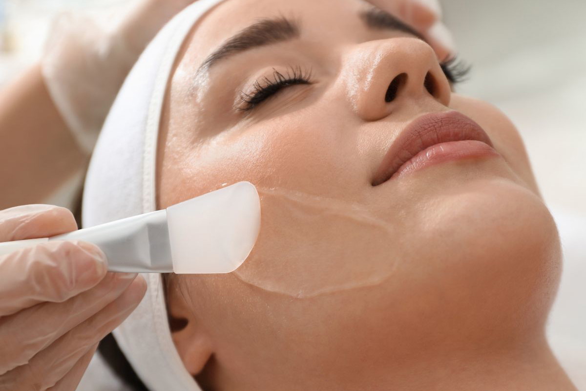 peeling chemiczny