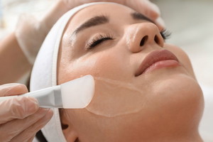 peeling chemiczny