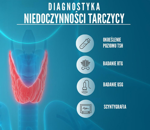 niedoczynnosc-tarczycy-diagnostyka-2435773-7a0e773