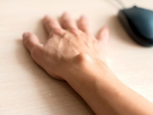 ganglion-nadgarstka-2494970-83626bd