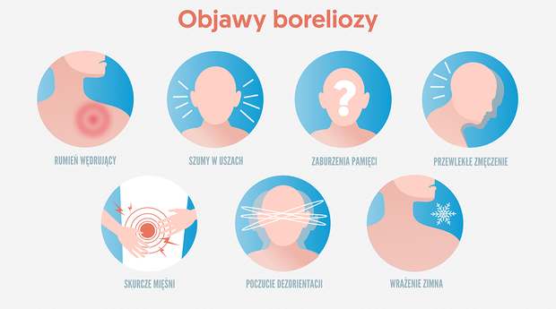 objawy-boreliozy-2435307-e782512