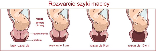 rozwarcie-szyjki-macicy-jpg-2503859-f3cc6e6