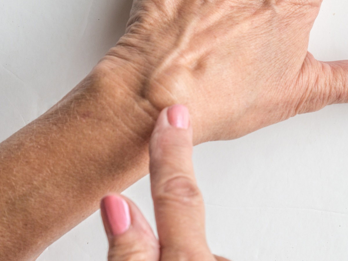ganglion