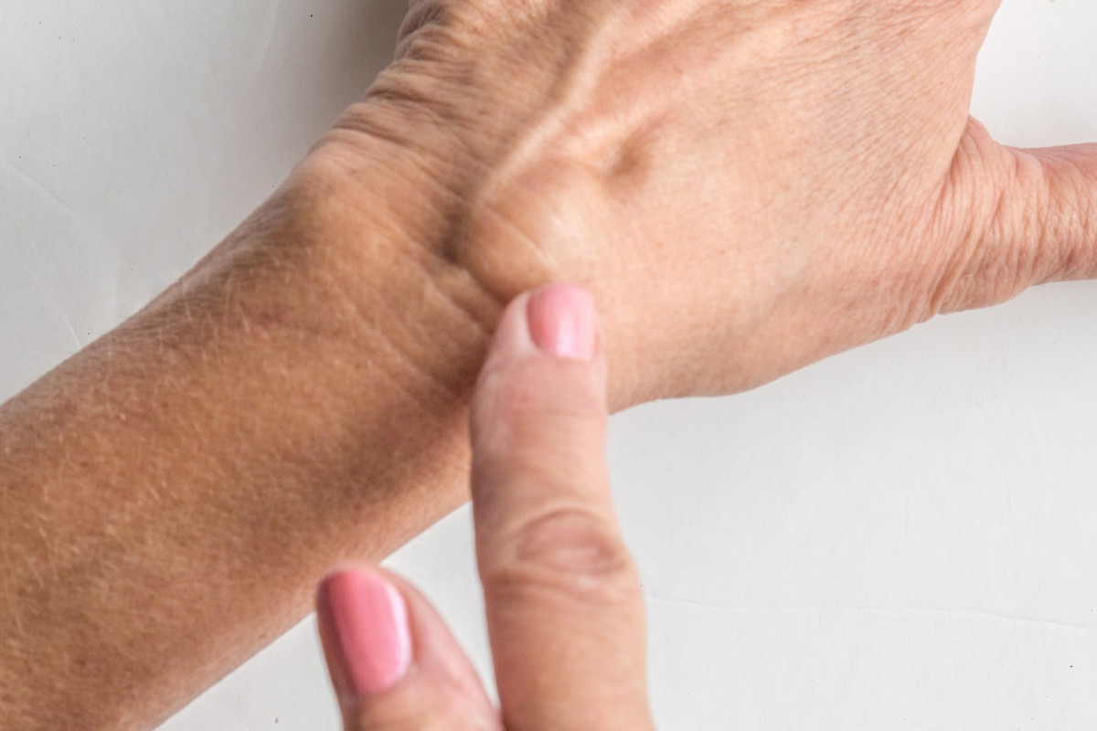 ganglion