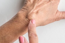 ganglion