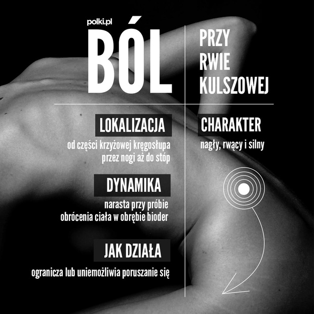 rwa-kulszowa-objawy-2440148-1497ef6