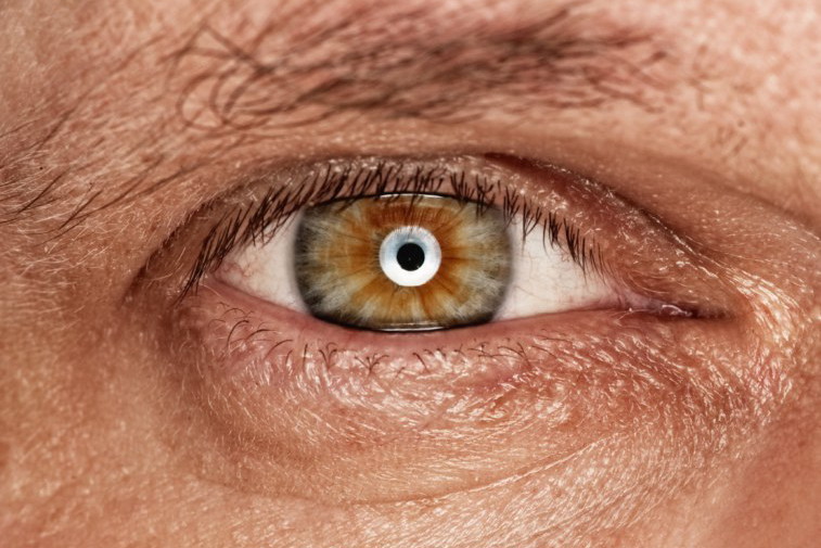 Fotolia