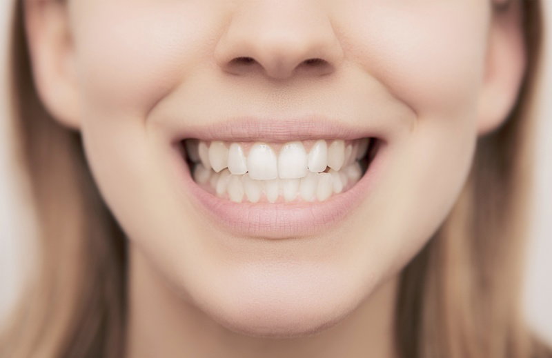 Fotolia