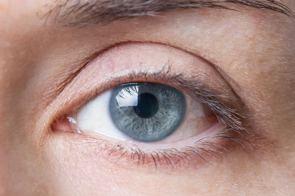 Fotolia