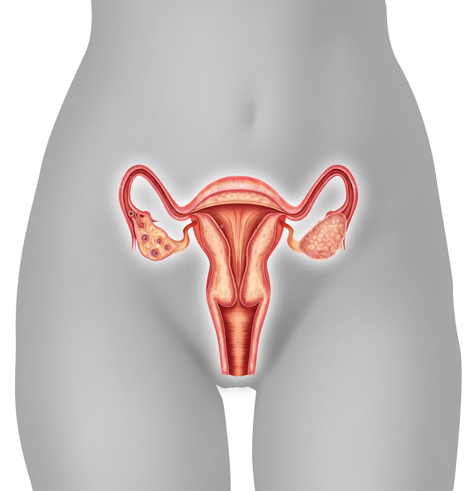 Fotolia