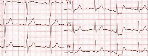 2243065-1ea6951