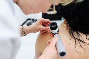 Badanie pieprzyków u dermatologa