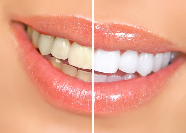 Smiling woman mouth with great teeth. Over white background