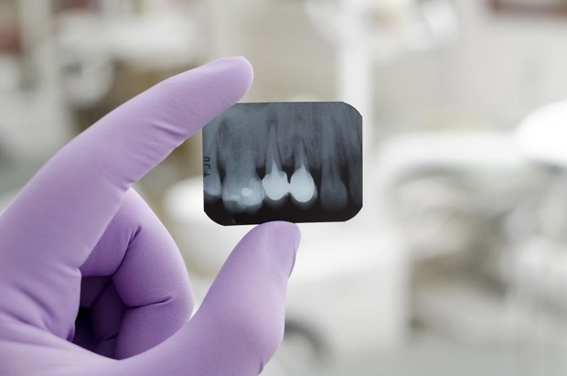 Doctor holding and looking at dental x-ray