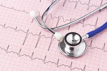 EKG
