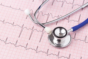 EKG