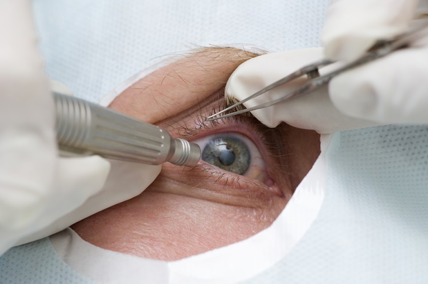 Treatment of an eye by ultrasound