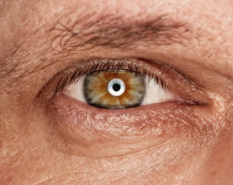 Fotolia