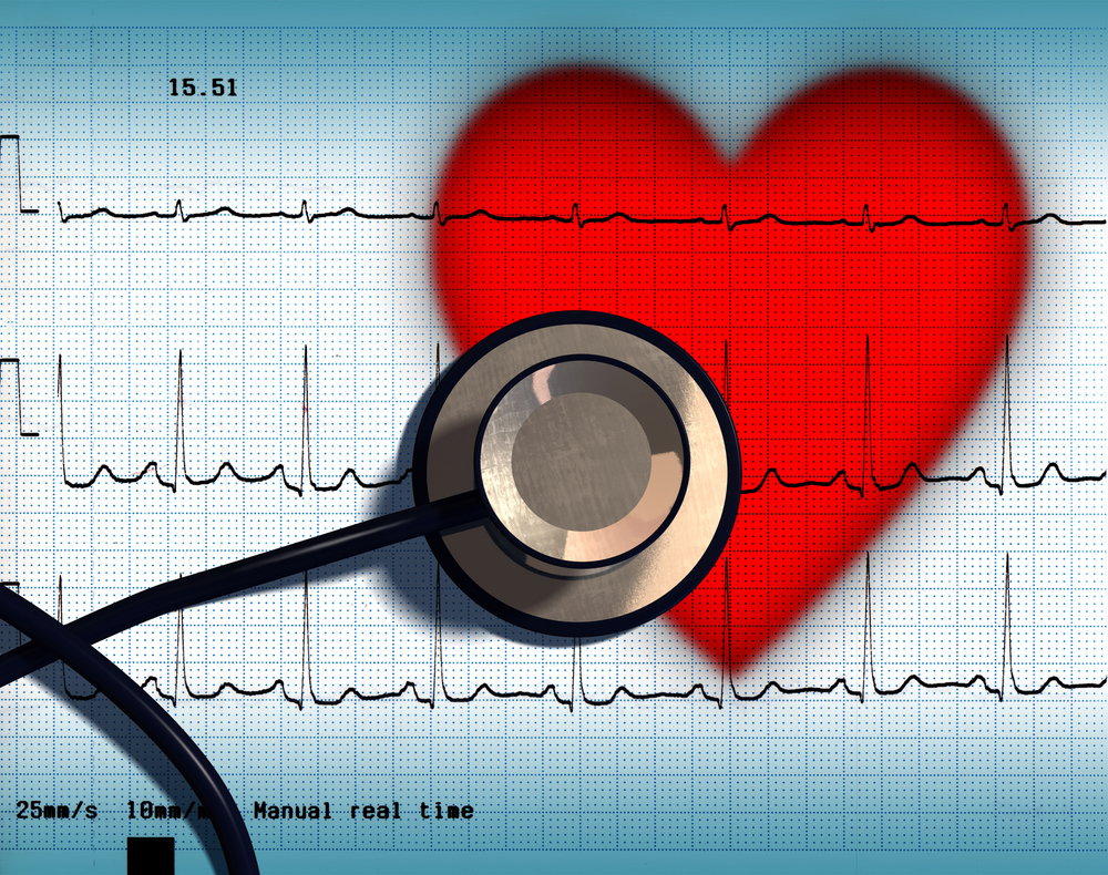 Nieznane