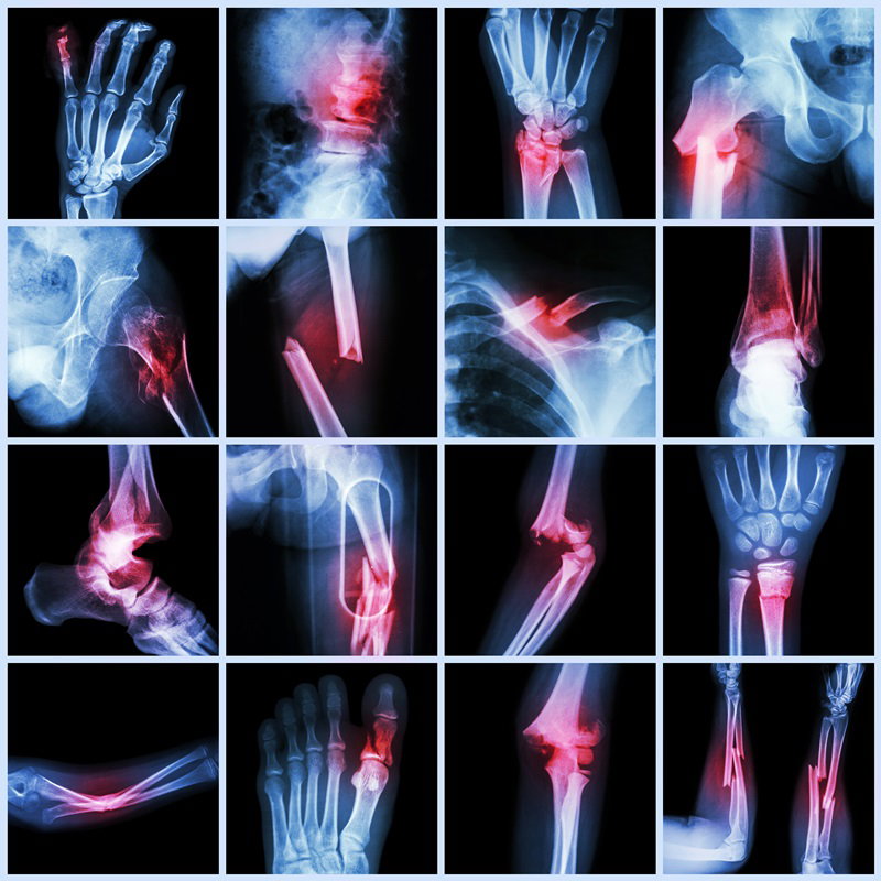 Fotolia