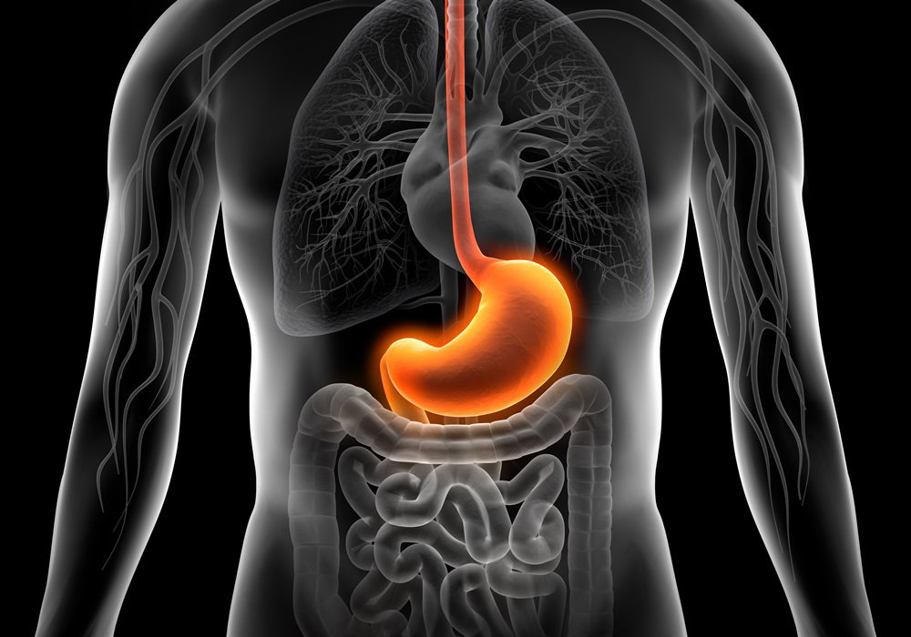 Fotolia