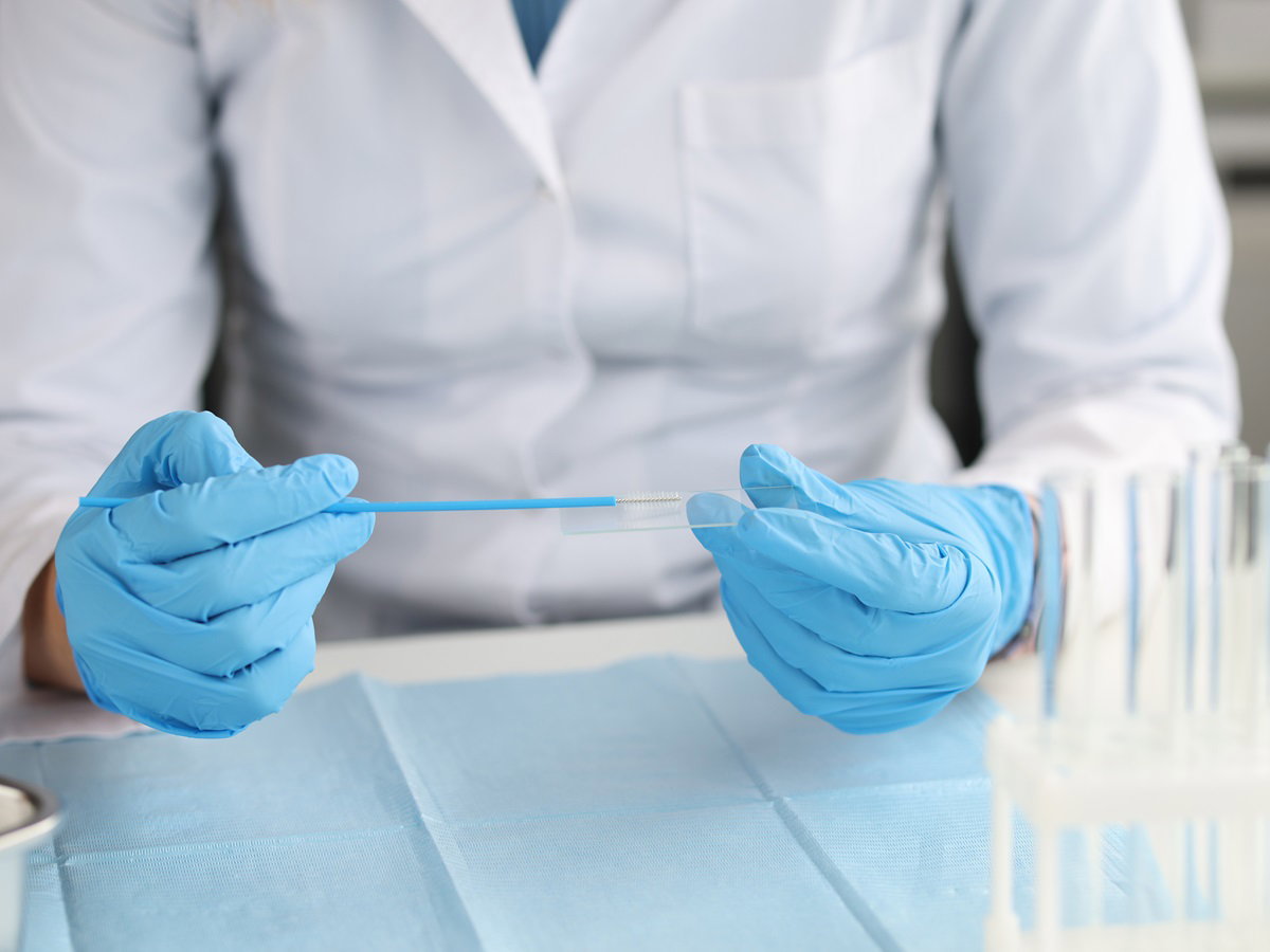 cytologia jak się przygotować