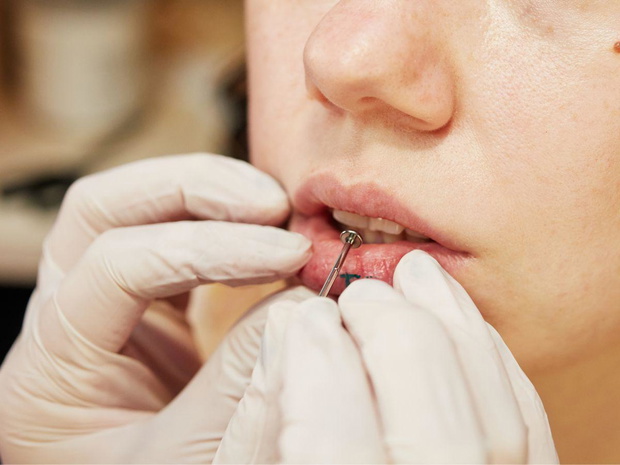 kolczyk-w-wardze-lip-piercing-jak-wyglada-przeklucie-ile-sie-goi-ile-kosztuje-rodzaje-kolczykow-2500374-104baab