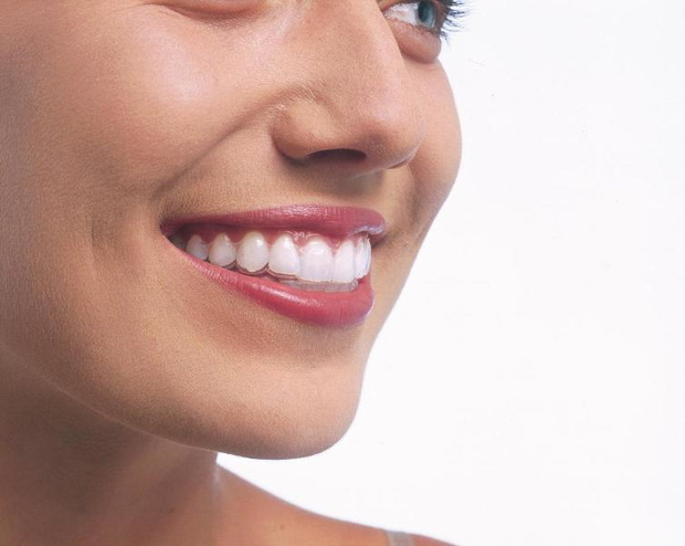 aparatinvisalignfotdentimclinic1-2686992