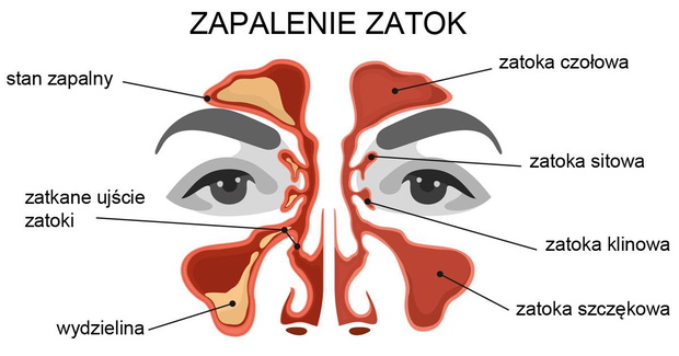 co-daje-masaz-na-zapalenie-zatok-2507175-1183022