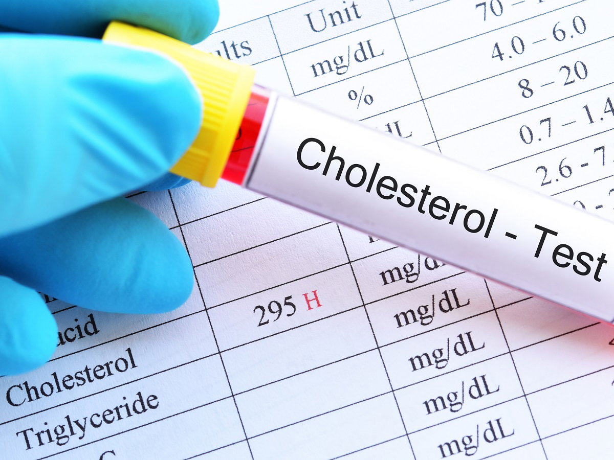 cholesterol normy wiekowe