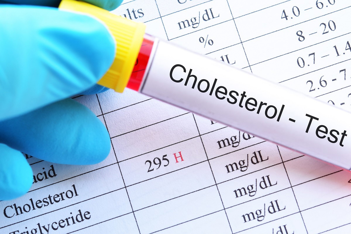 cholesterol normy wiekowe