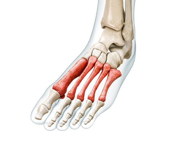 domowe-sposoby-bol-srodstopia-2517742-fbdd2d9