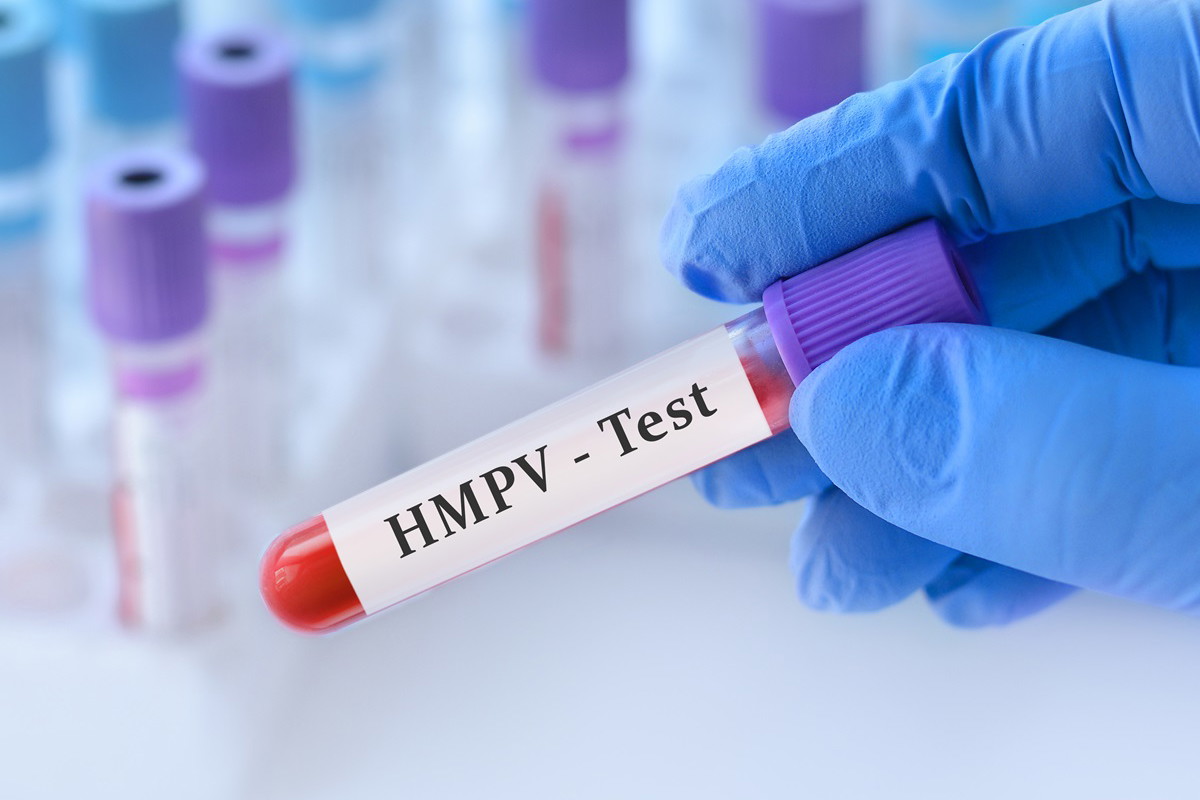 wirus HMPV