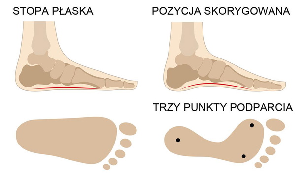 cwiczenia-na-plaskostopie-pozycja-skorygowana-2501229-fdabfb5
