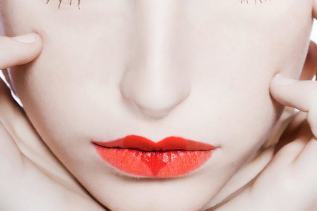 Anemia