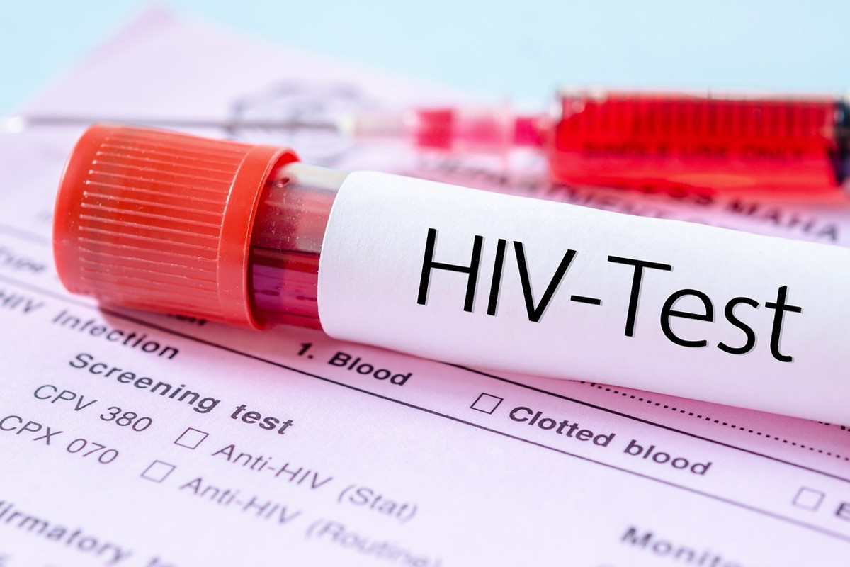 hiv