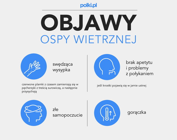 ospa-objawy-2443222-f08a34c