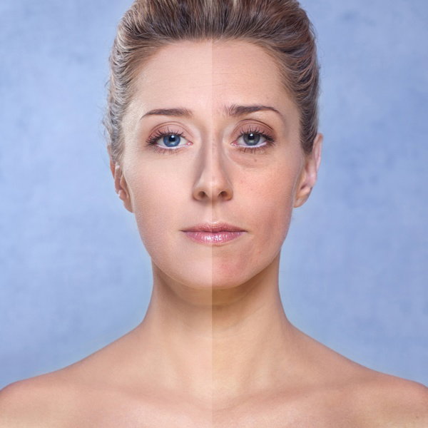 Fotolia